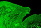 080822-color-calcium-01 Section of a rat tongue stained for the Calcium-Sensing Receptor (CaSR)